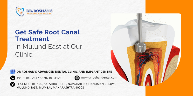 root canal treatment in mulund east