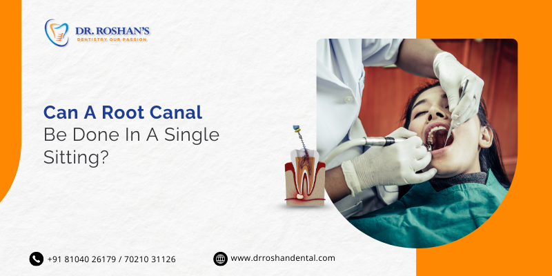 Can a Root Canal Be Done in a Single Sitting?