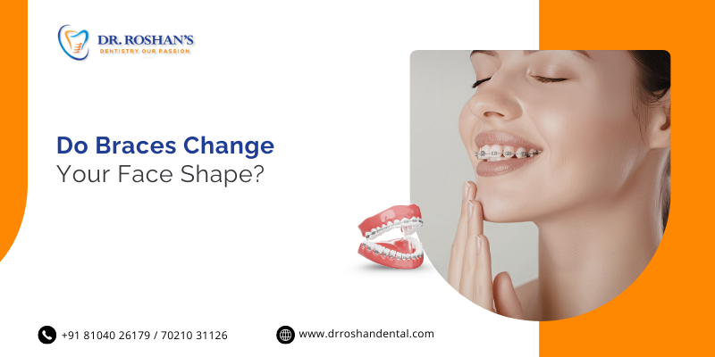 Do Braces Change Your Face Shape?