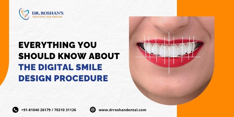 Everything You Should Know About The Digital Smile Design Procedure