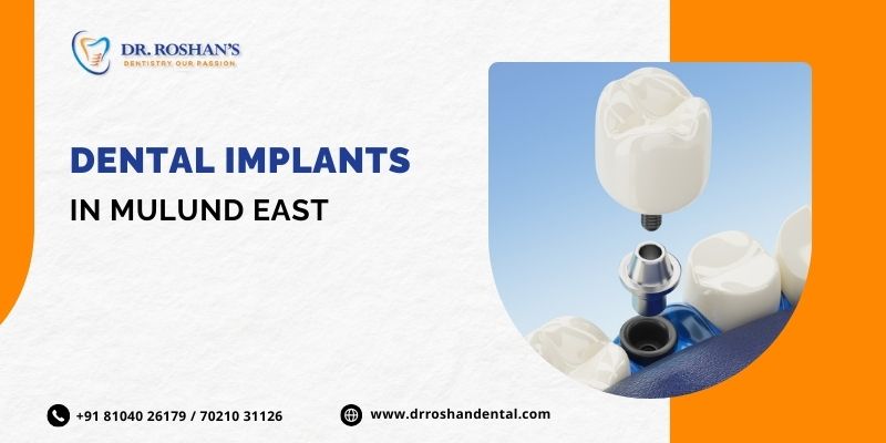 Find Out If Dental Implants Are Right For You