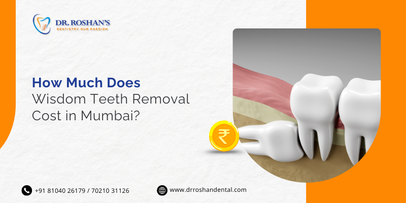 How Much Does Wisdom Teeth Removal Cost In Mumbai?