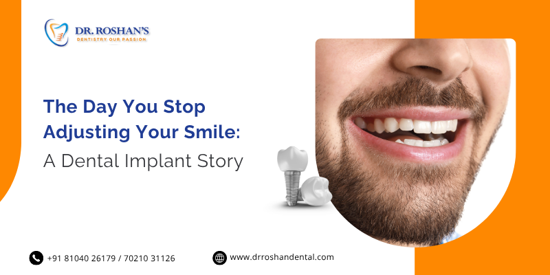 The Day You Stop Adjusting Your Smile: A Dental Implant Story