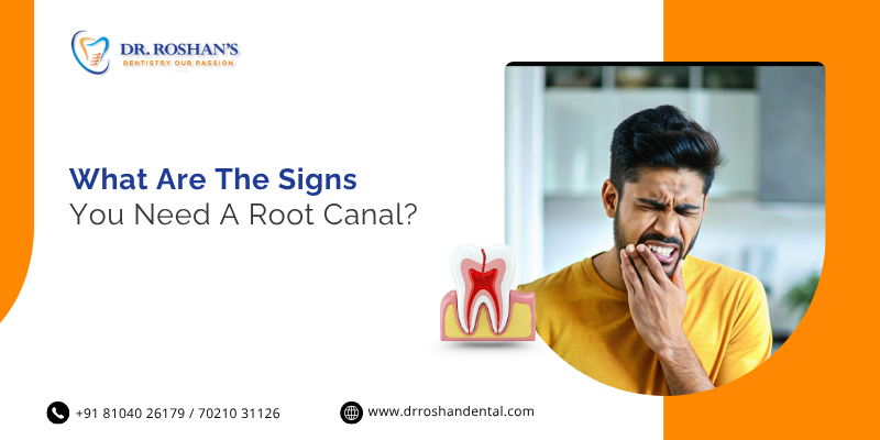 What Are the Signs You Need a Root Canal?